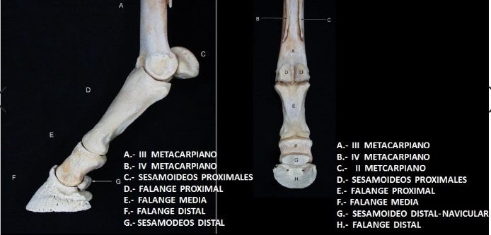 Fractura: cauze, simptome și tratament