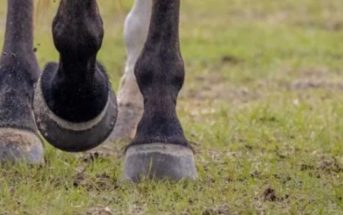 Síndrome del Navicular