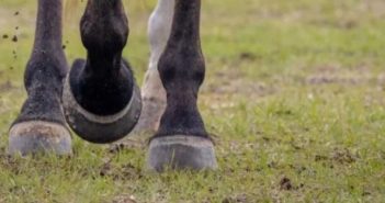 Síndrome del Navicular